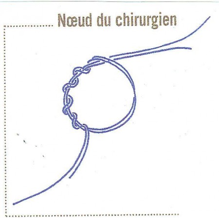 noeud de chirurgien